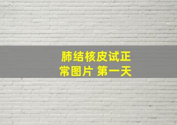 肺结核皮试正常图片 第一天